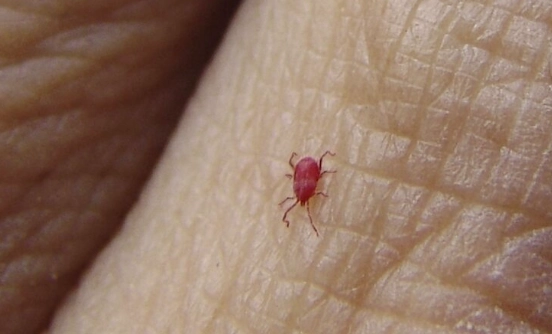 chigger bites treatment