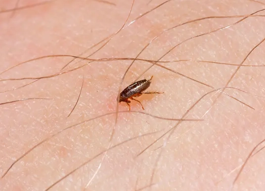 how to get rid of fleas