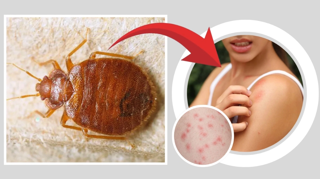 how can you get bed bugs