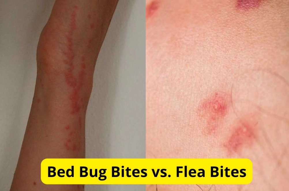 bed bug infestation bed bug infestation