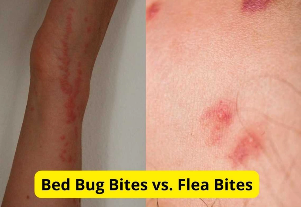 bed bug bites vs flea bites bed bug bites vs flea bites