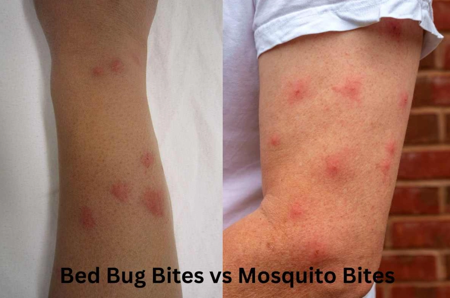 bed bug bite symptoms bed bug bite symptoms