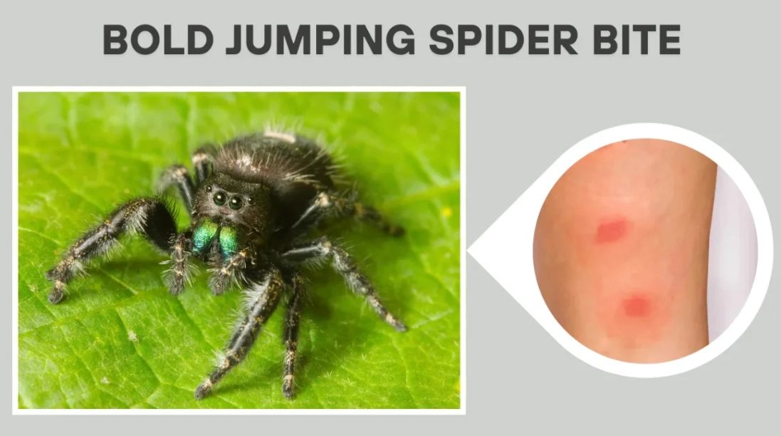 jumping spider bite symptoms jumping spider bite symptoms