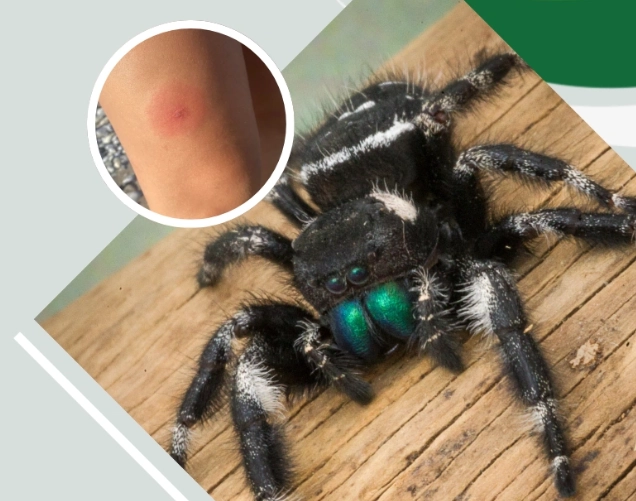 jumping spider bite symptoms jumping spider bite symptoms